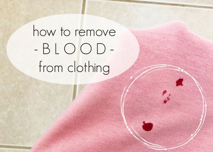 Cómo quitar la sangre de la ropa.