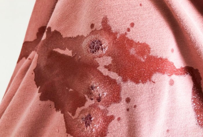 Cách tẩy vết máu trên quần áo