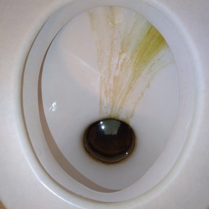 Hur man rengör en toalett från rost och plack med egna händer